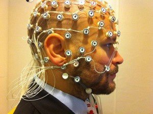 électroencéphalographie